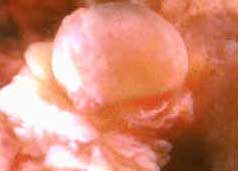 مراحل تكوين الجنين في رحم الأم لنقول : لا اله الا الله !! G4z4-c12