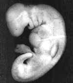 مراحل تكوين الجنين في رحم الأم لنقول : لا اله الا الله !! G4z4-c16