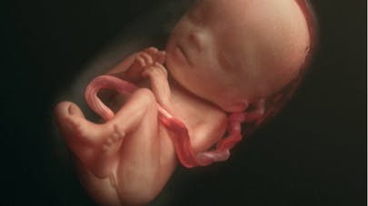 Pourquoi l'avortement? Semain10