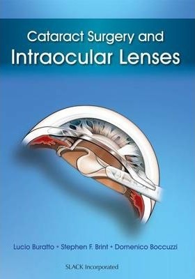 Cataract Surgery and Intraocular Lenses 97816110