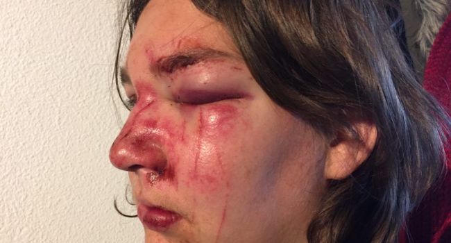 Bike-jacking violent à Toulouse : la police lance un appel à témoins 20160213