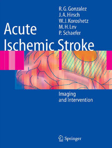 Acute Ischemic Stroke 000c4010