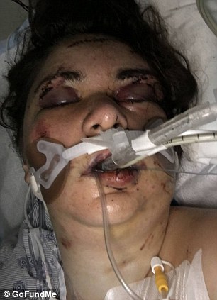 MIAMI WOMAN, 23, LEFT IN COMA AFTER SHE WAS 'ATTACKED BY MALE ROOMMATE SHE FOUND ON CRAIGSLIST WHO STRANGLED HER AND CUT HER UP ON HER BIRTHDAY' 31654513