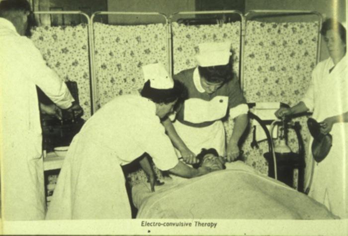 electroconvulsivotherapie