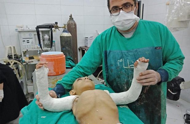 الدكتور محمد لكلوك بطب المنيا يجري عملية نادرة لطفل مصاب بـ"العظام الزجاجي" Caoi10