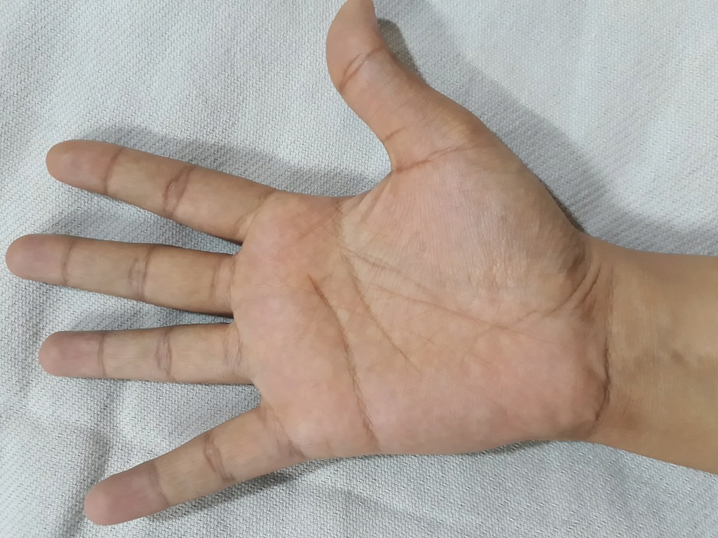 Please read my palm and tell me about my marriage. Thanks Rightp11