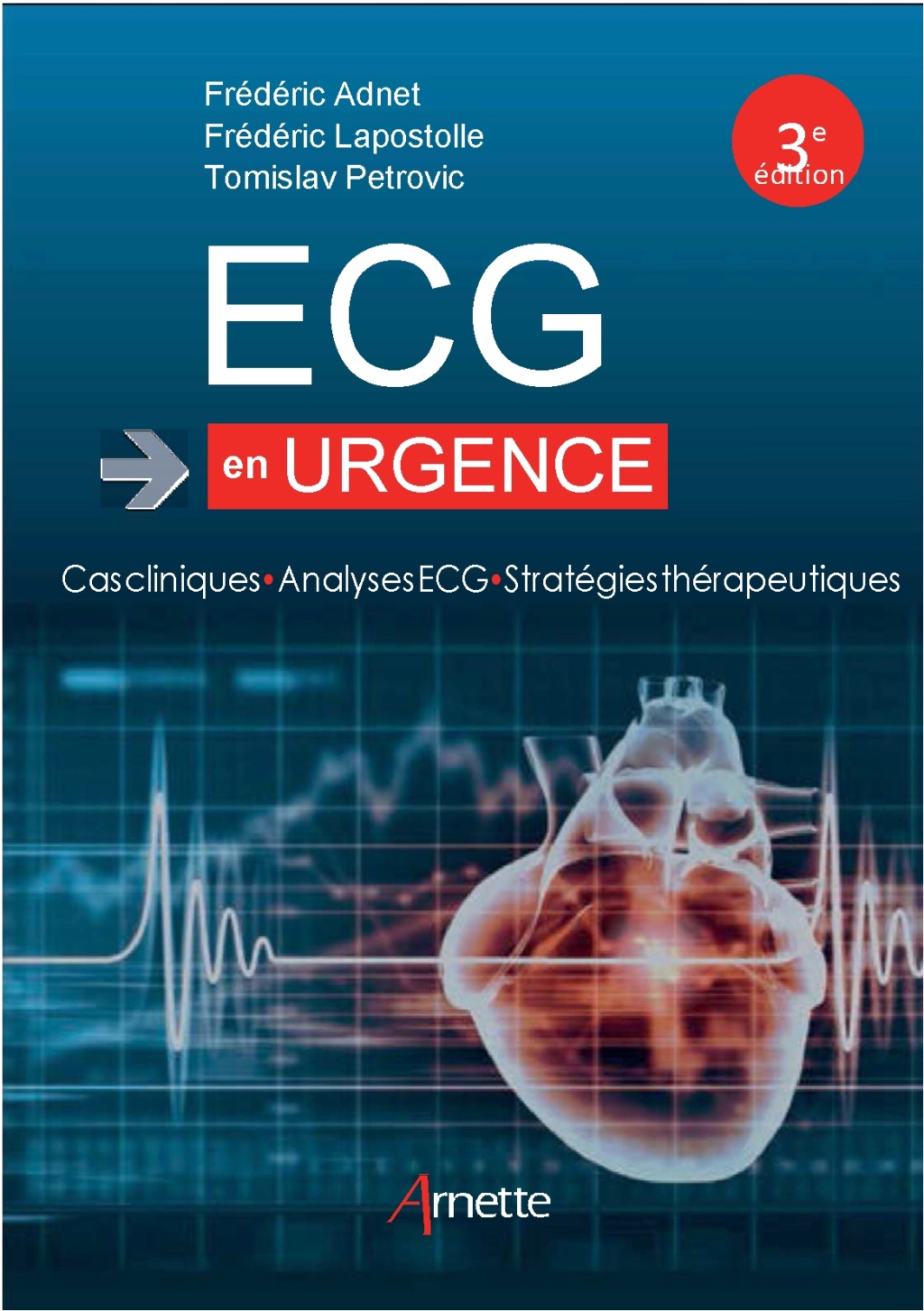 urgence - Livres Médicales - ECG en urgence: Cas cliniques - Analyses ECG - Stratégies thérapeutiques 2018 Ecg_en10