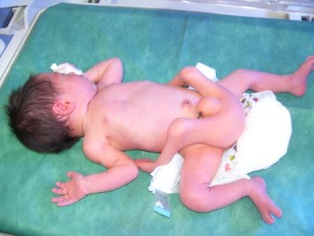 سيده في سوريا تضع مولود بأربعة أرجل ( صور ) 32067310