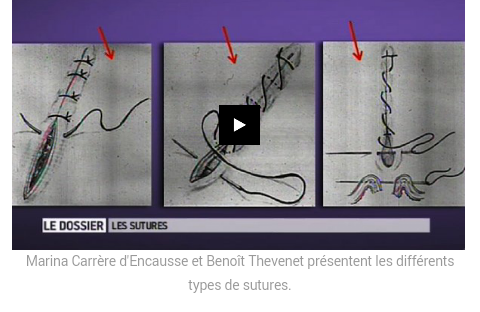 Des plaies et des sutures Screen12