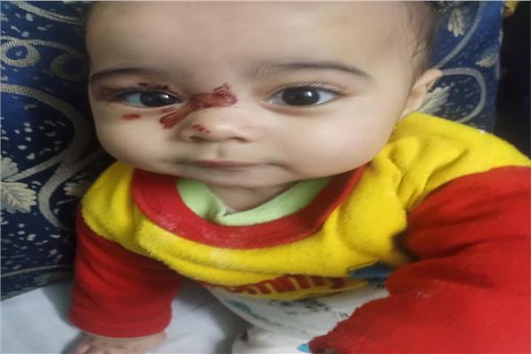 إلقاء القبض على والدى الطفلة الرضيعة ساجدة  " 6 شهور " بتهمة تعذيبها و حرقها و كسر فى عظامها 20200415