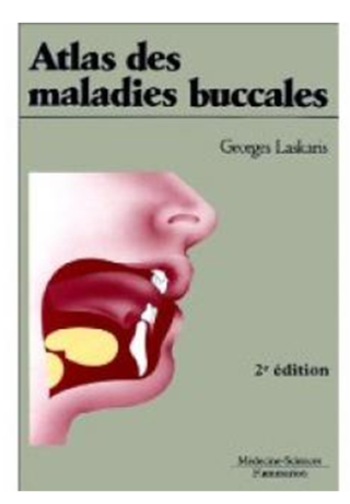 Atlas des maladies buccales 49636410