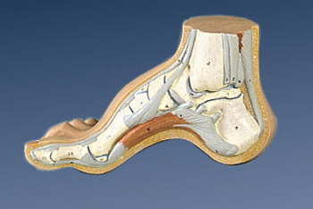 Foot Problems Pes Cavus or High Foot Arch* Highar10