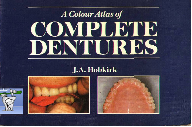 تحميل كتاب A Colour Atlas of Complete Dentures 314