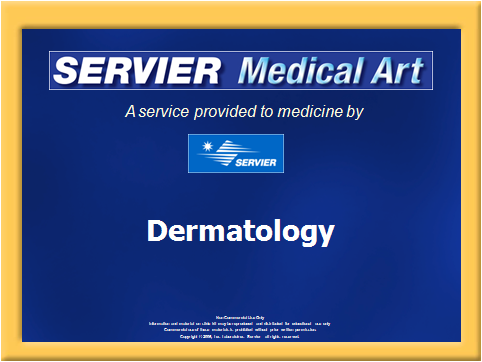 Dermatology Image110
