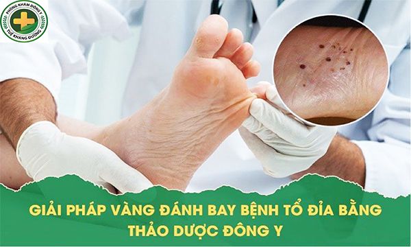 Phòng khám y học cổ truyền Tuệ Khang Đường chuyên điều trị tổ đỉa Tuekha12