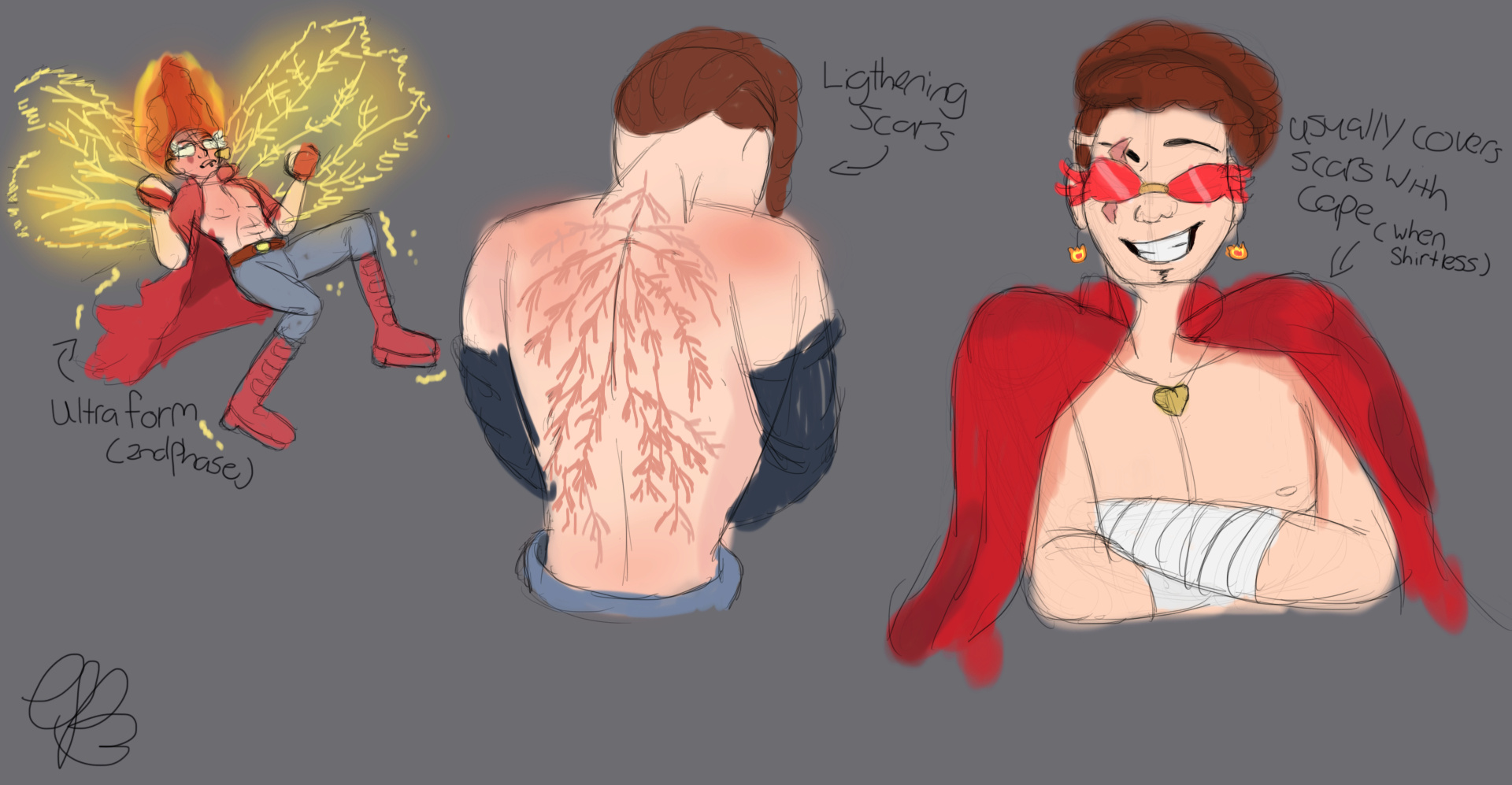These are the scars FB got when he first gain his ligthening/electric powers, he's a bit sore about them since it reminds him of the day his mom passed