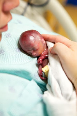 L'embryon est une personne Embryo18