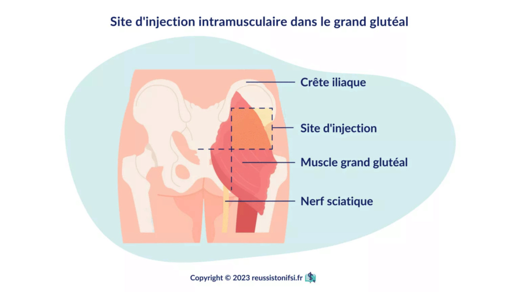 resume les injections intramusculaires Infogr15