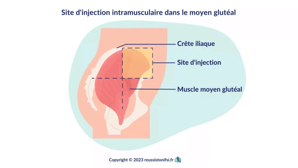 resume les injections intramusculaires Infogr16