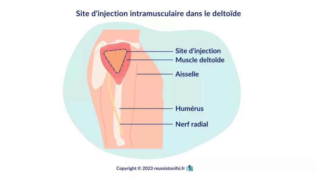 resume les injections intramusculaires Infogr17