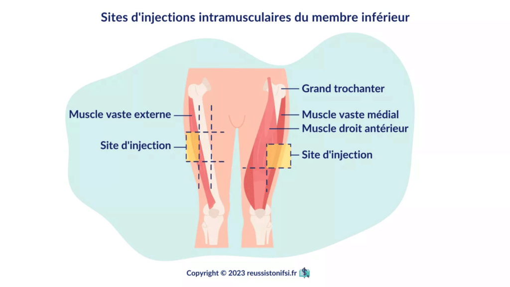 resume les injections intramusculaires Infogr18