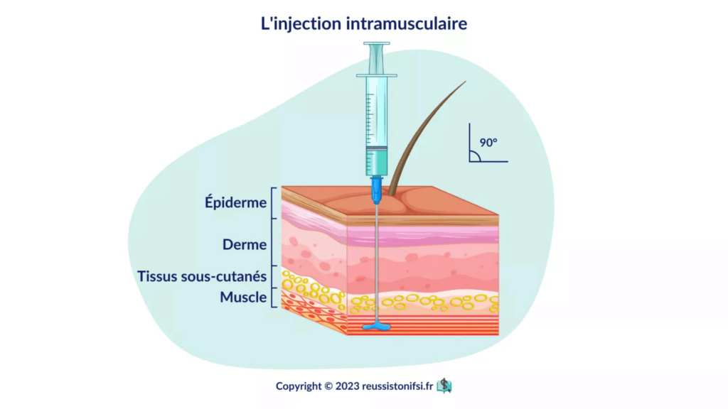 resume les injections intramusculaires Infogr20