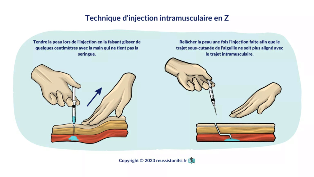 resume les injections intramusculaires Infogr21