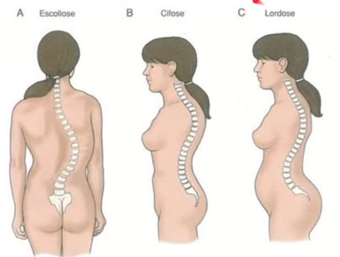 Radiologia da coluna vertebral- Fabíola Captur10