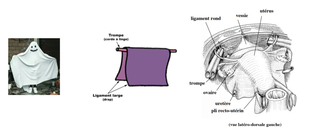Artère utérine et lames portes vaisseaux : mésomètre, paramètre, ligament large Captur39