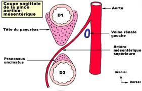 pince aorto mésentérique  Pince_10