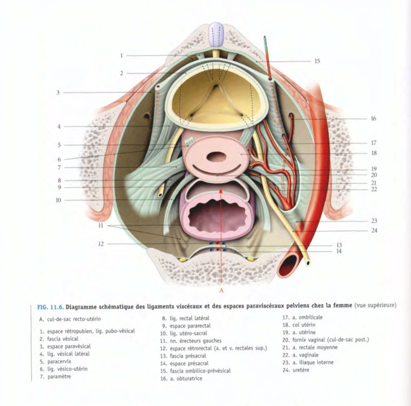 Artère utérine et lames portes vaisseaux : mésomètre, paramètre, ligament large Sans_t10