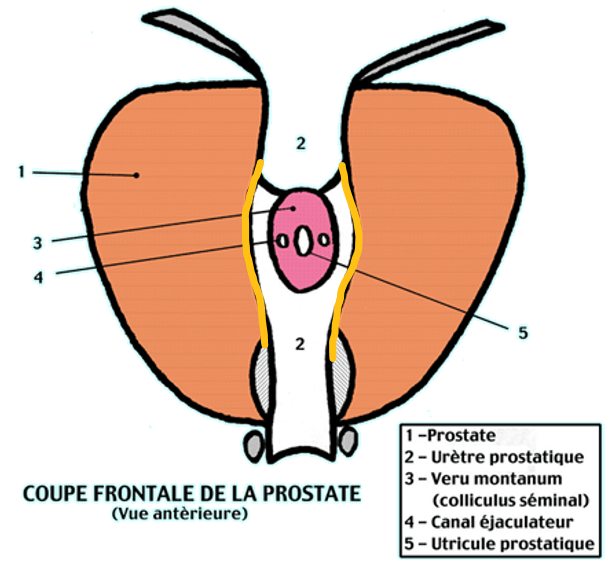 Sinus prostatique Veru_210