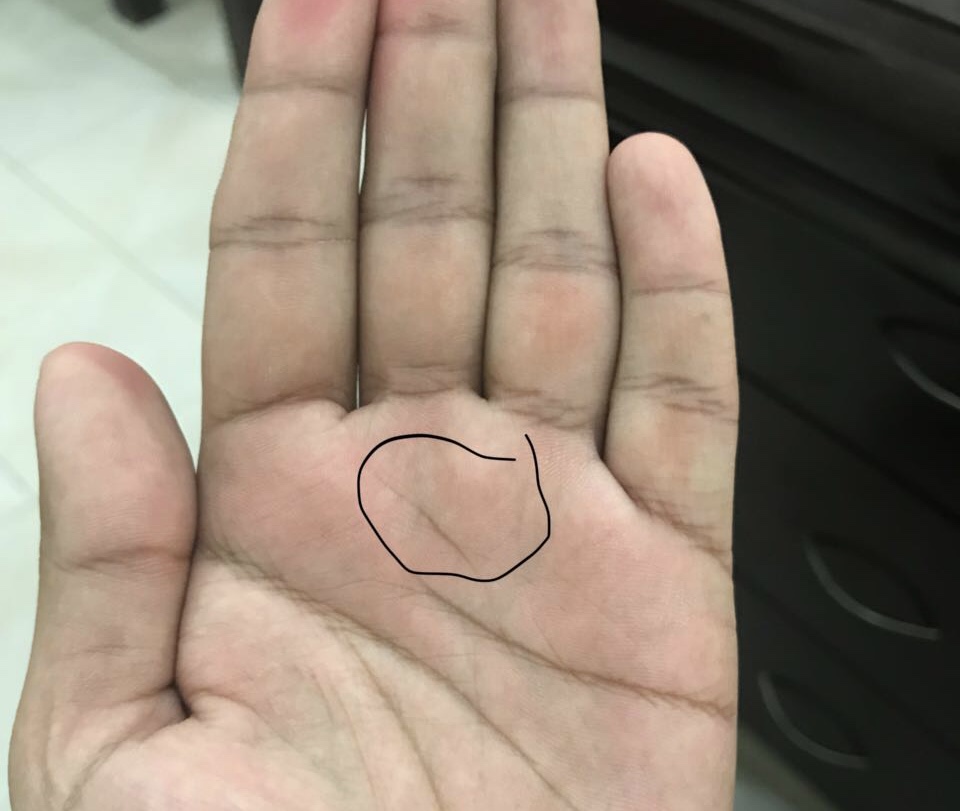What are these lines? 6f739210