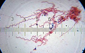 البكتيريا اللولبية 20100910
