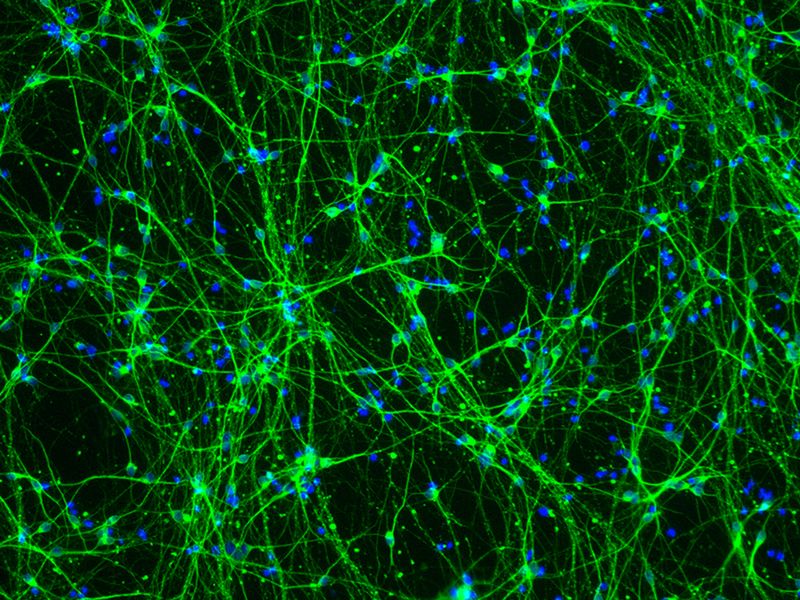 Células madre 'reprogramadas' para ser probadas en personas con Parkinson D4158610