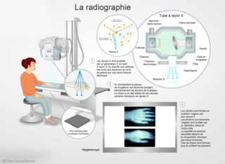 Radiologie  Radiog10