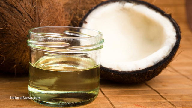 ALZHEIMER'S PATIENT REVERSES SYMPTOMS WITH DAILY COCONUT OIL Coconu10