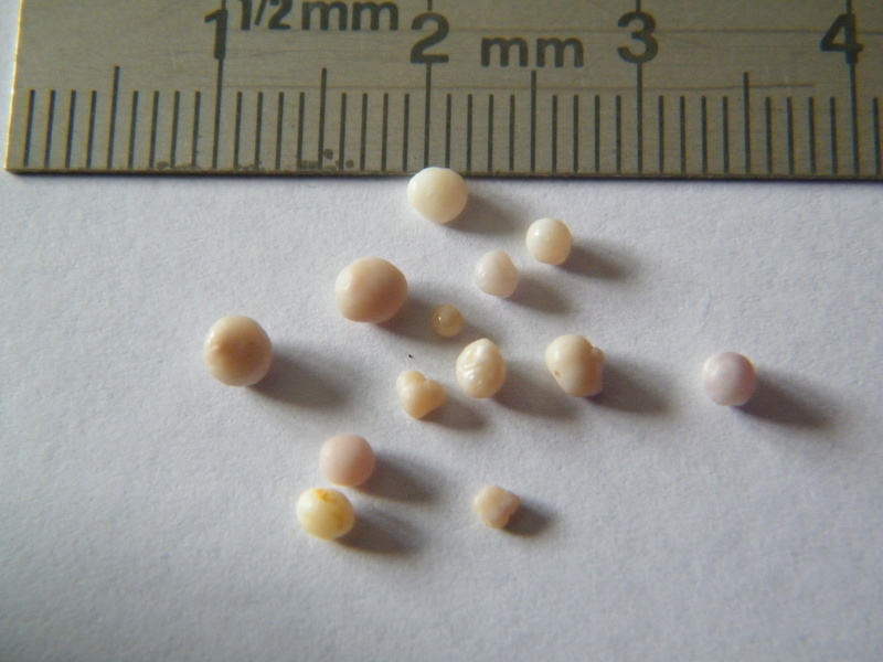 Perles Moules Dscf2335