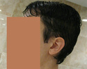 Hair Around The Ears Thinning (Pictures) Hair10